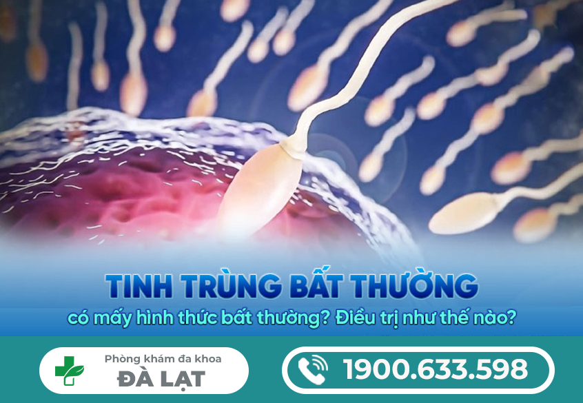 TINH TRÙNG LOÃNG LÀ GÌ TINH TRÙNG LOÃNG CÓ CON ĐƯỢC KHÔNG?